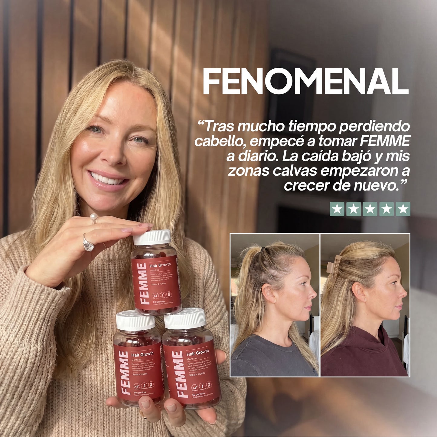 FEMME® Gomitas Anticaída y crecimiento