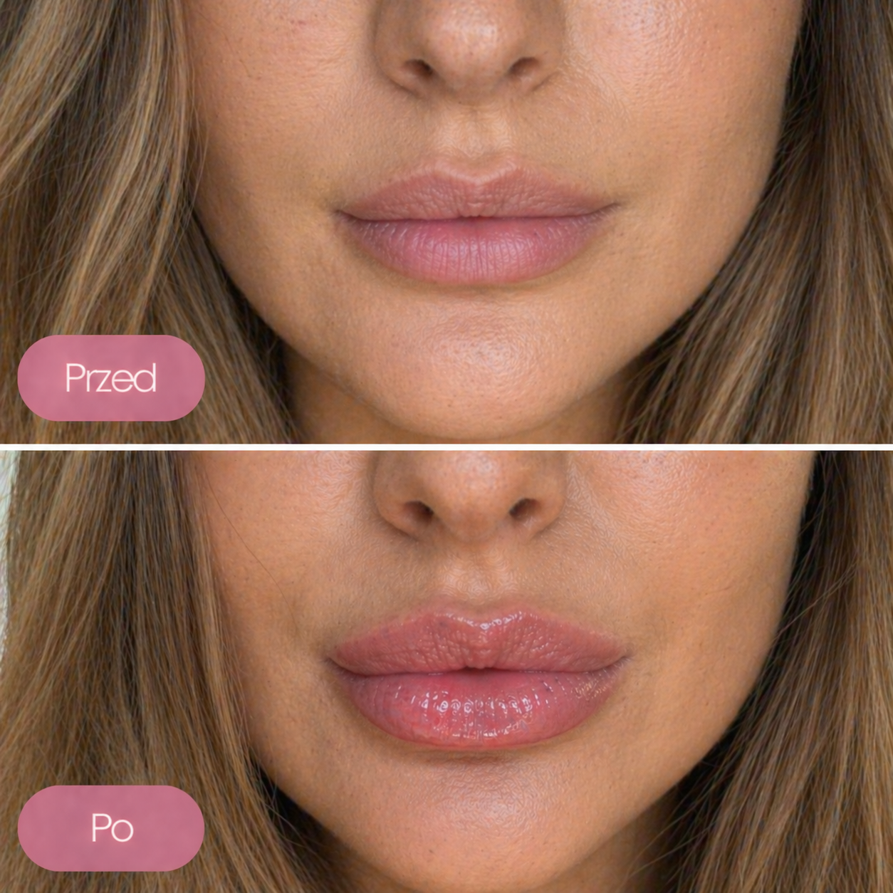 Aumentador de labios FEMME
