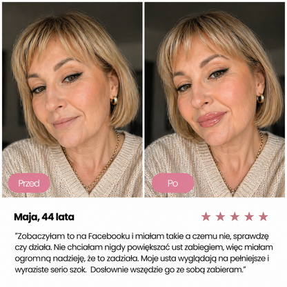 Aumentador de labios FEMME